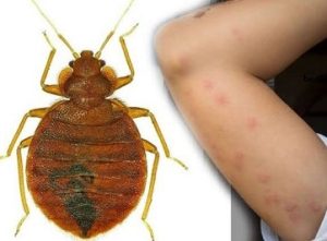 bed bugs control in Kampala Uganda bed bugs control in Kampala Uganda