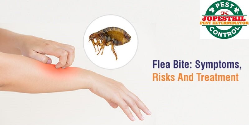 Fleas & how to get rid of fleas in Kenya?
