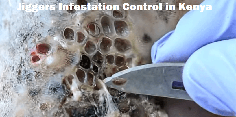 Jiggers Control in Kenya