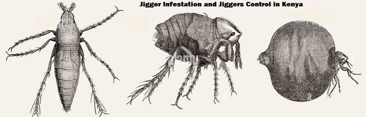 Jiggers Infestation Control in Kenya