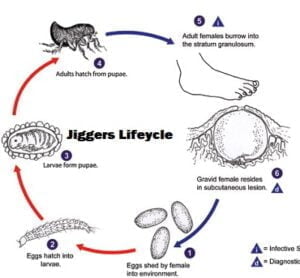 Jiggers Control in Kenya