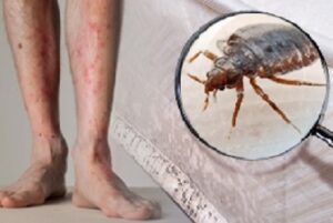 Bedbugs control services in Kenya